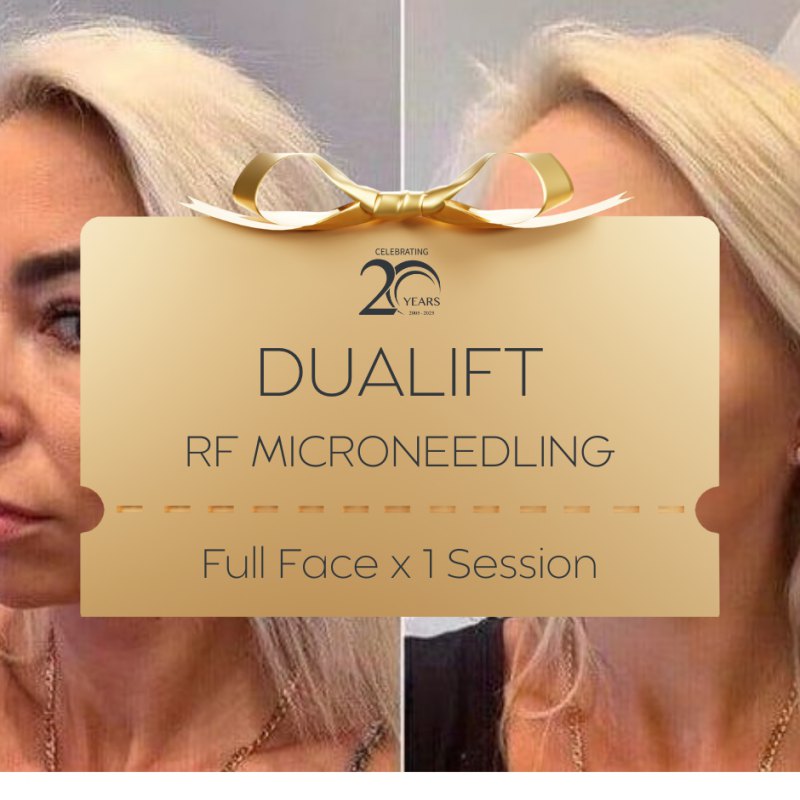 20YRS Full Face Dualift RF Microneedling (Morpheus 8)