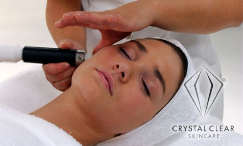 Crystal Clear Microdermabrasion 30 min Course of 10
