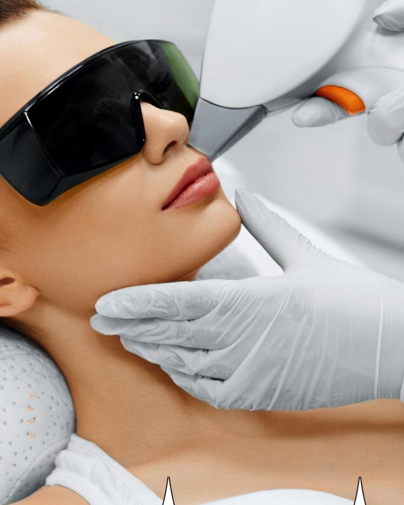Face Laser Hair Removal