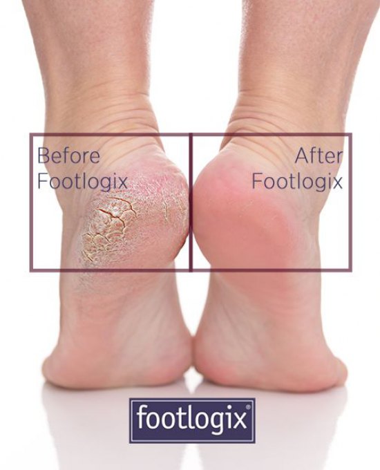 Footlogix Pedicure (no polish)