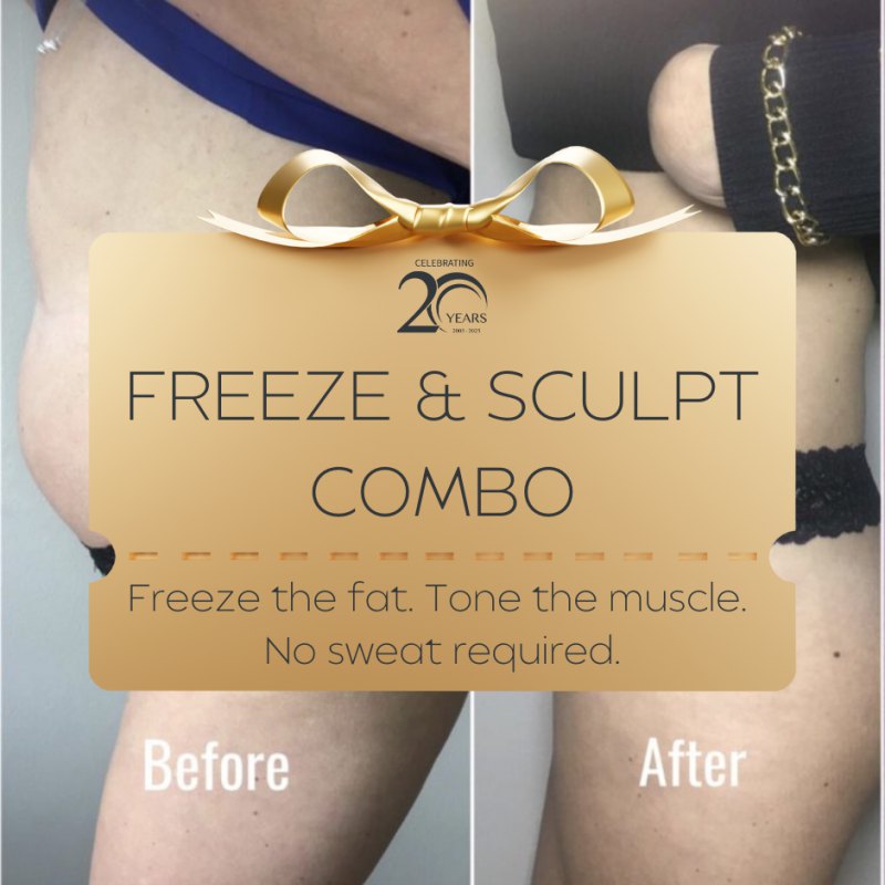 20YR Freeze & Sculpt Combo