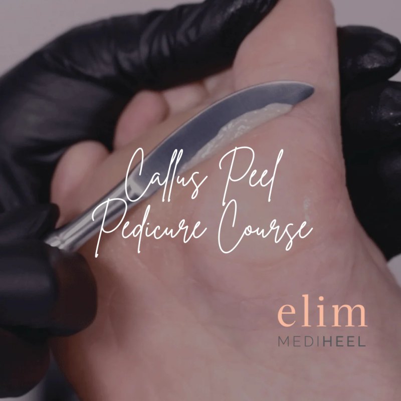 Elim Callus Peel Course Bundle – 4 Treatments to Smooth Your Summer!