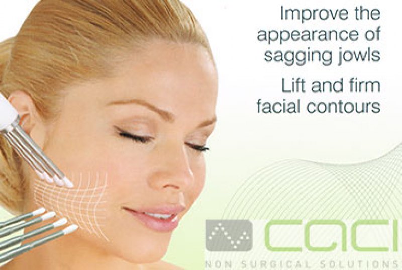 Intensive Course of 10 CACI Non Surgical Face Lifting Treatments 