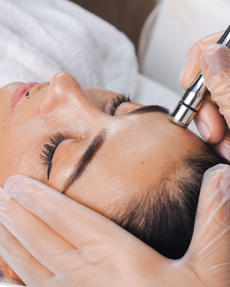Microdermabrasion Facial
